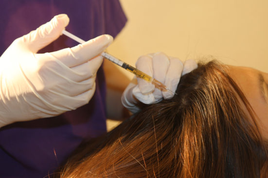 hair transplant clinic in dubai