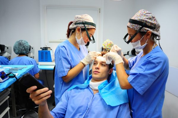 عملية زراعة الشعر للنساء