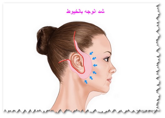 شد الوجه بالخيوط الذهبية