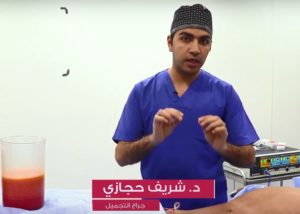 دكتور شريف حجازي شفط الدهون